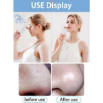 Portable Electric Rechargeable Bubble Blackhead Remover Pore Vacuum Cleaner with Interchangeable Heads - Image 11